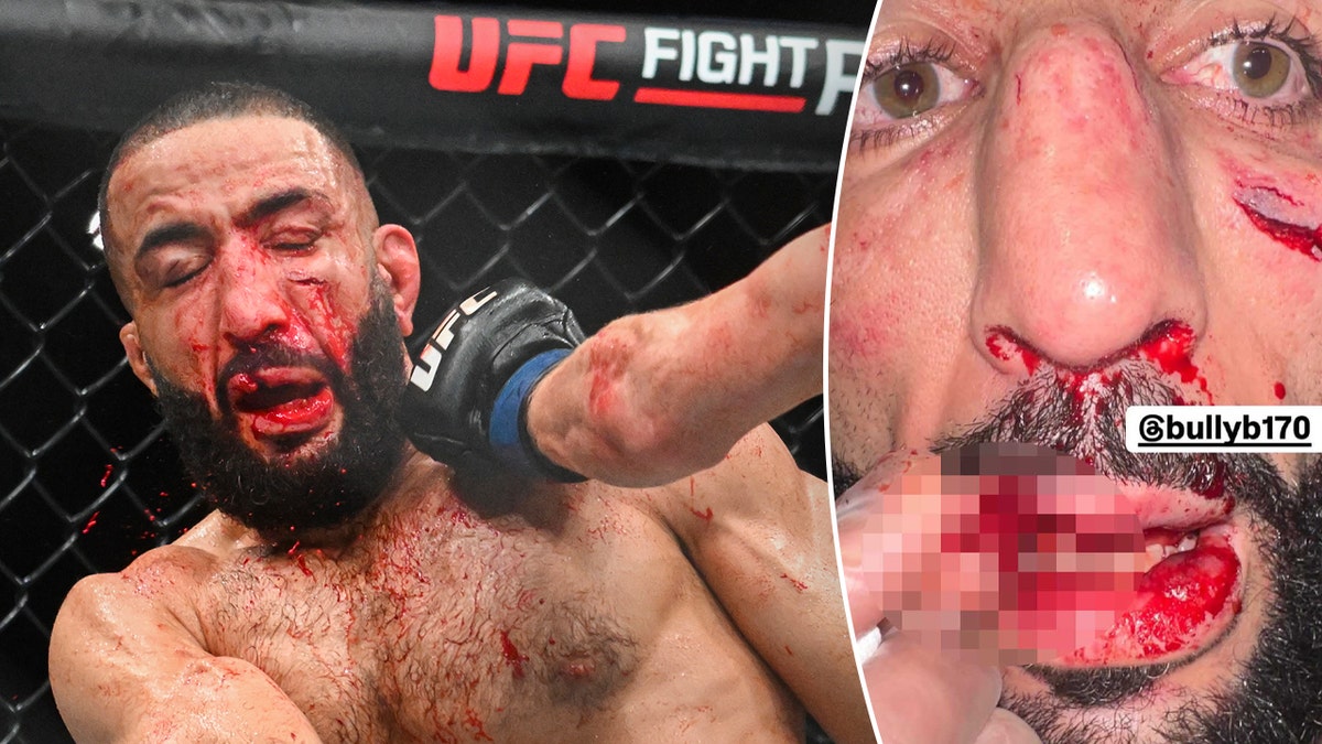 Belal Muhammad hurt bad